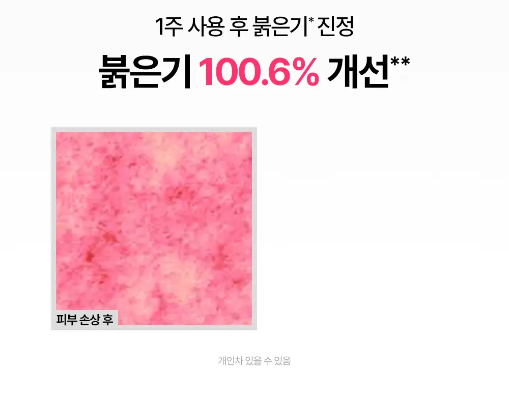 [붉은기 진정 앰플] 제로이드 핌프로브 카밍 앰플 30ml 상세페이지 16